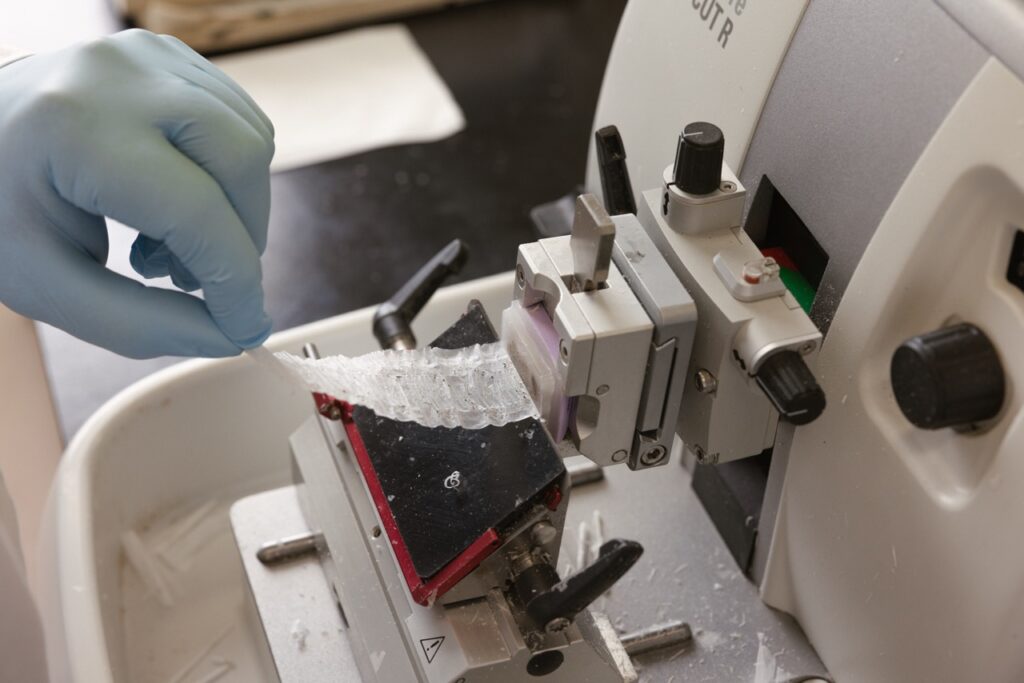 Anatomical pathology